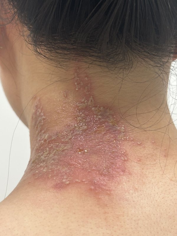 金牛财富 有人因此“毁容”！警惕“飞行的硫酸”，这种小虫千万别拍，这样处理最有效